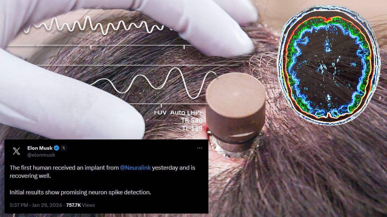 Neuralink, de Musk, realiza implante de chip cerebral em humano